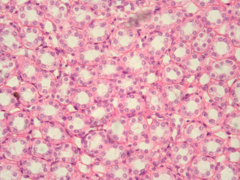 <p>What type of tissue is this?</p>