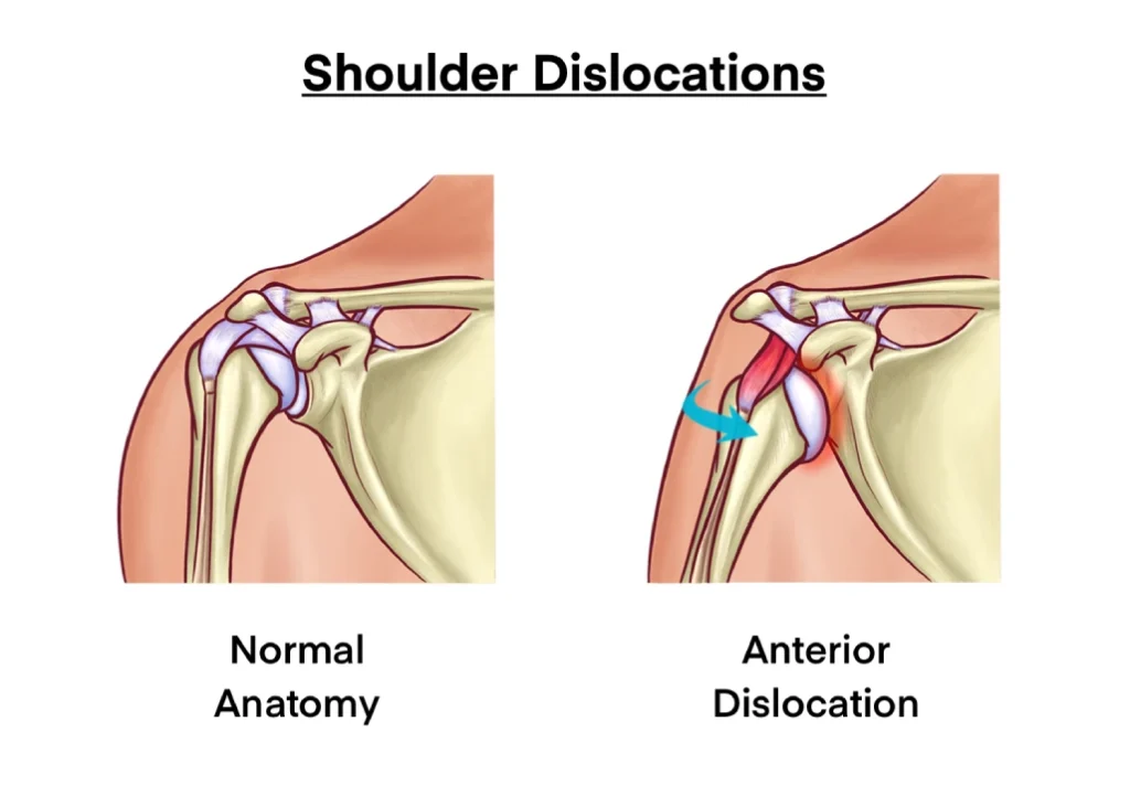 <p>What injury / condition? </p>