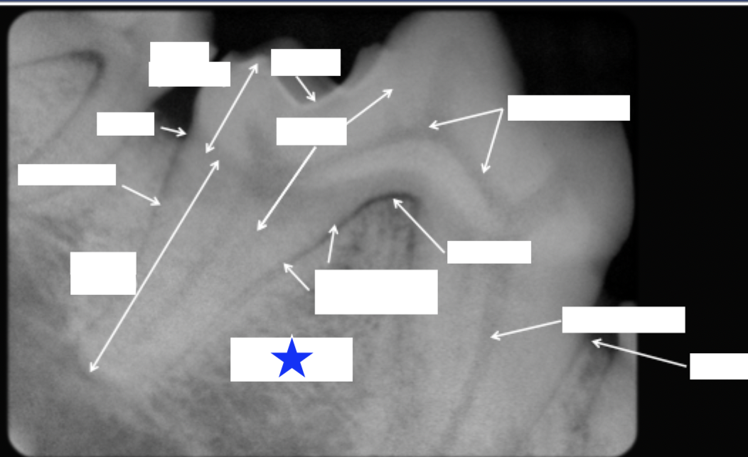 <p>What part of the tooth is indicated by the star?</p>