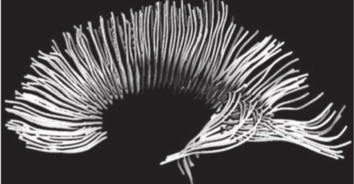 <p>structures of axon fiber tracts via <u>anisotropic diffusion</u> of water molecules</p>