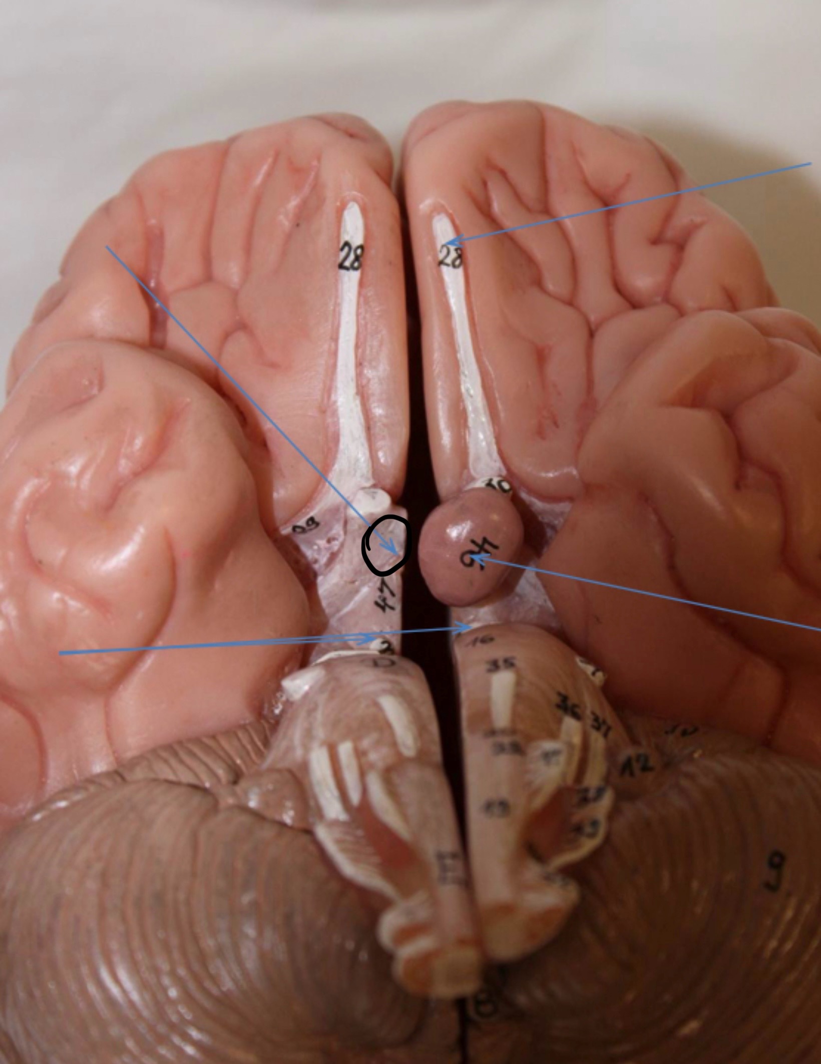 <p>Identify the circled area?</p>