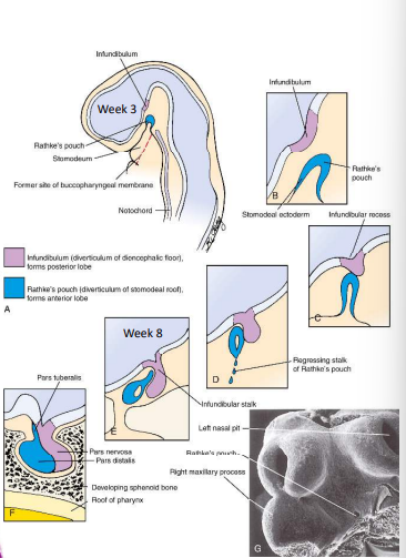 <p>At week 3, the infundibulum (posterior pit) migrates towards Rathke’s pouch (anterior pit). As they begin to fuse, the stalk of Rathke’s pouch regresses and the infundibular stalk forms.</p>