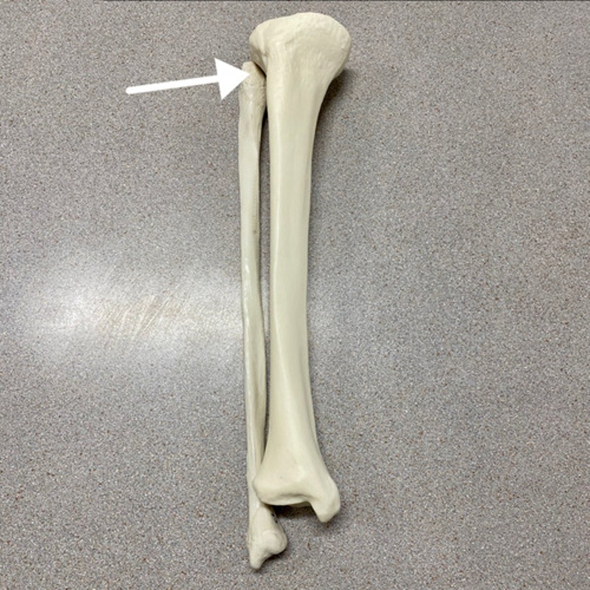<p>What is this?</p>