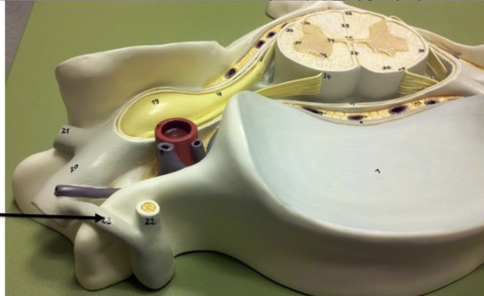 <p>found at T1- L2 spinal nerves only, contains axons of sympathetic visceral motor fibers</p>