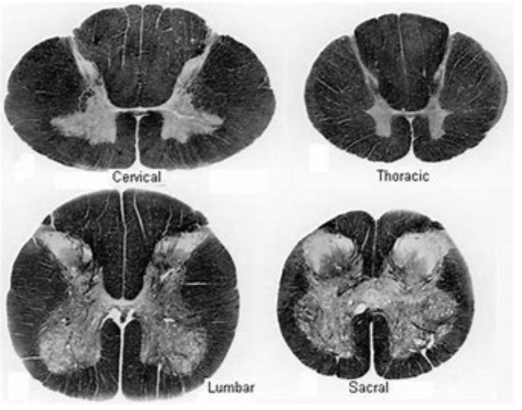 <p>contained within the vertebral column and runs from the foramen magnum to the 1st lumbar vertebra</p><ul><li><p>nerve fibers continue below L1—> cauda equina</p></li><li><p>gray matter (interneurons, cell bodies) in the middle and white matter (axons and myelin) surrounding</p></li><li><p>sends info between peripheral structures and the brain</p></li></ul><p></p>
