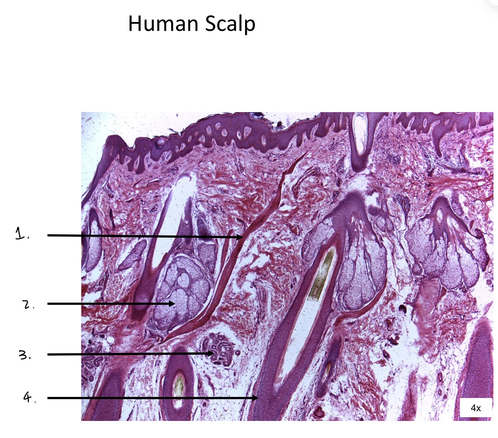 term image