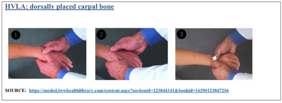 <p>Dorsal displaced = flexed sd</p><p>Ventral displaced = extended sd</p><ol><li><p>Pt seated, physician faces pt</p></li><li><p>Hold wrist like dx</p></li><li><p>Extend/flex into barrier while maintaining pressure</p></li><li><p>Thrust is baby whip further into barrier</p></li></ol><p></p>