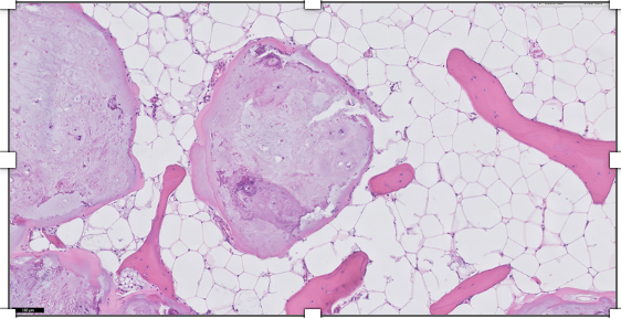 <p>lésion doigt homme de 30 ans</p><p>diagnostic</p><p>définition</p><p>age</p><p>topographie</p><p>anatomie</p><p>histologie</p><p>ihc et moléculaire</p>