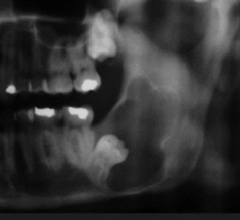 <p>What shape of lesion is this?</p>