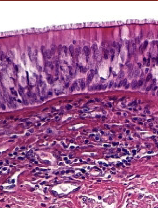 <p>What are those areas of no dye in the top layer of the ciliated columnar epithelium?</p>