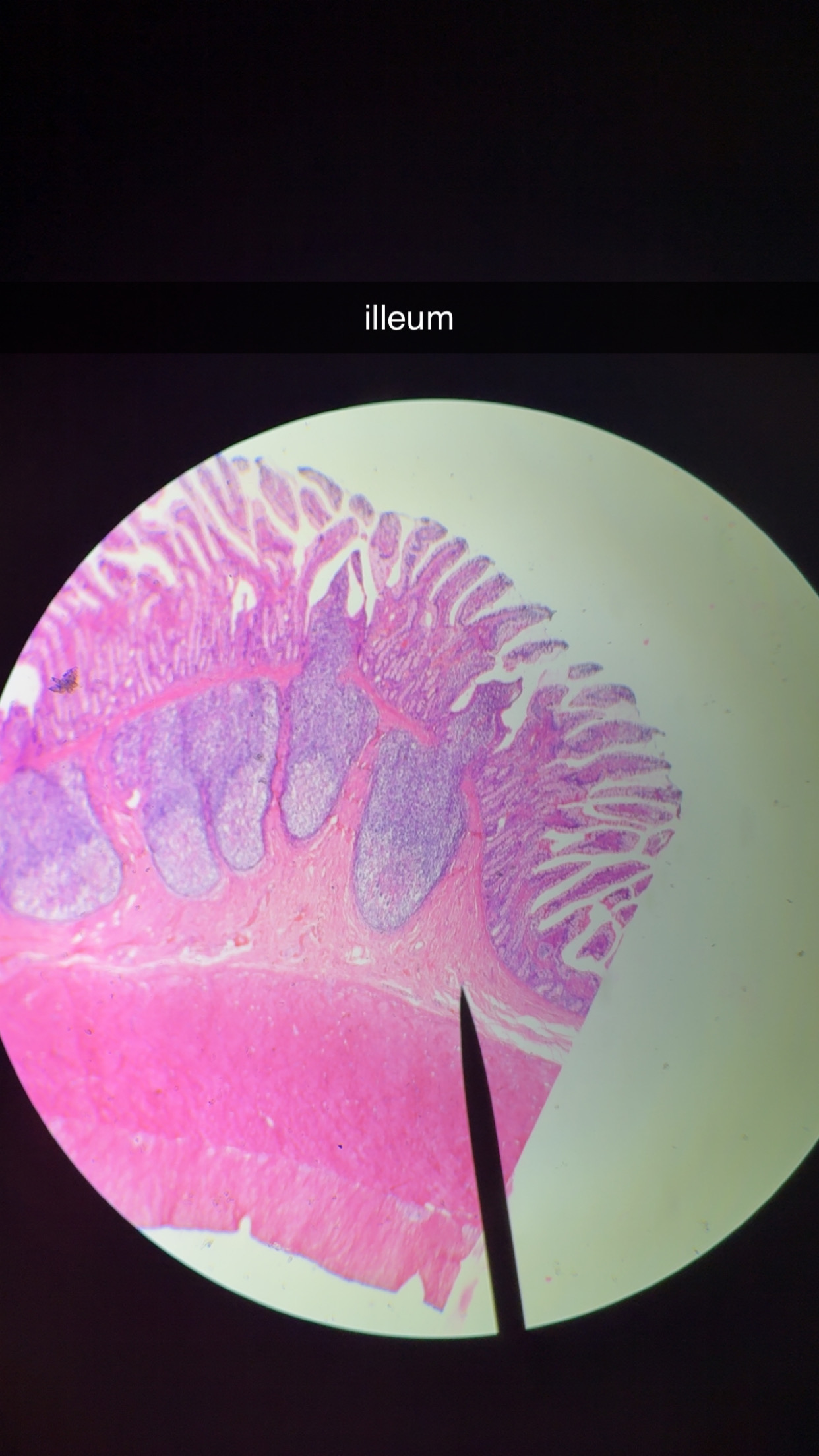 <p>ileum cells - 4</p>