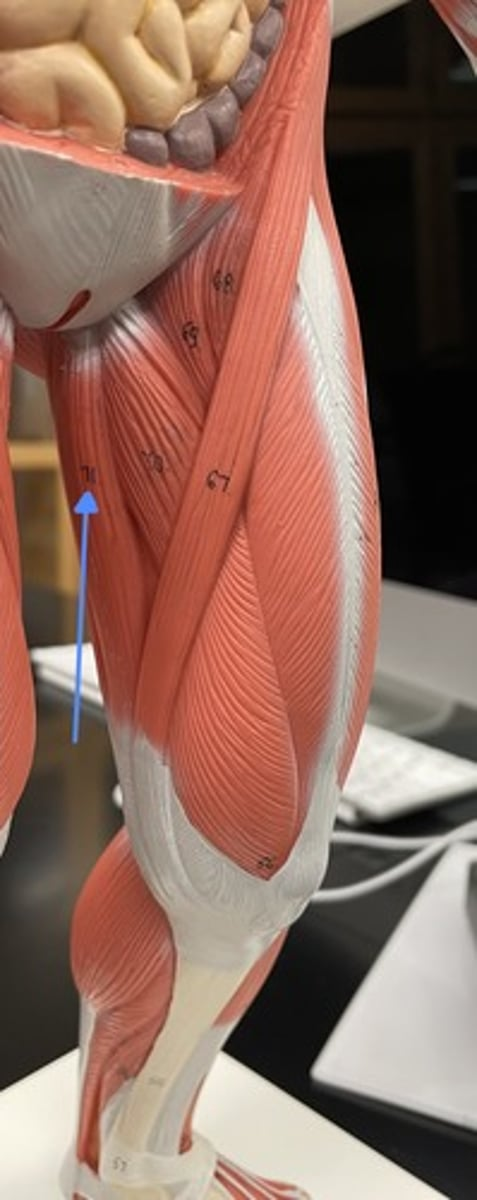 <p>gracilis </p><p>origin:</p><p>insertion:</p><p>action:</p>