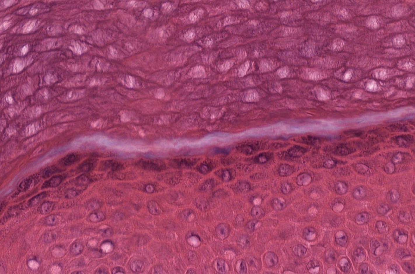 <p>Identify the layer below the keratin?</p>