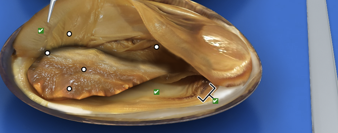 <p>What structure is this pointing to?</p>