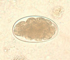 <p>Identify the organism</p>
