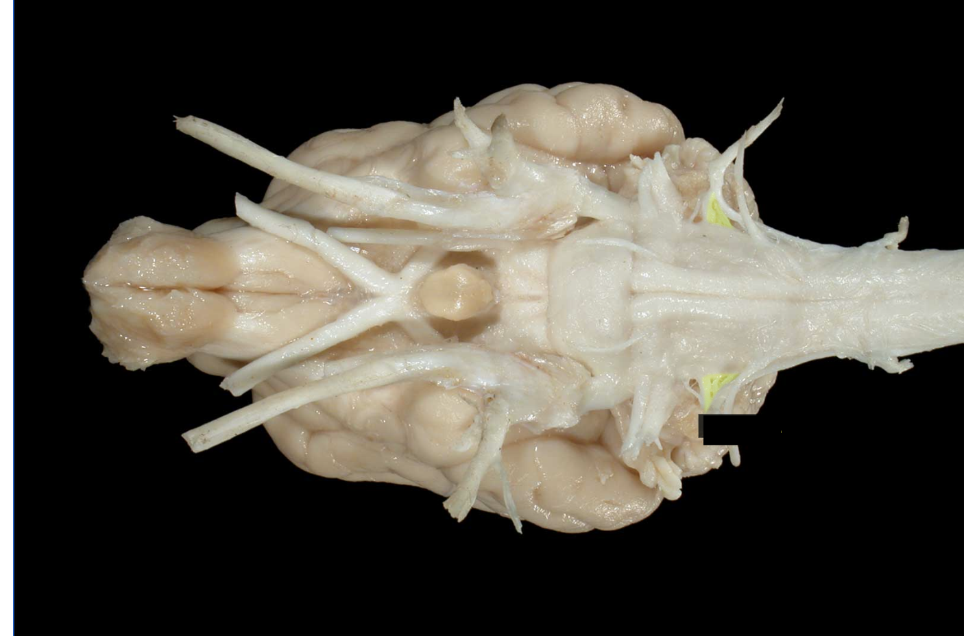 <p>what nerve is this</p>