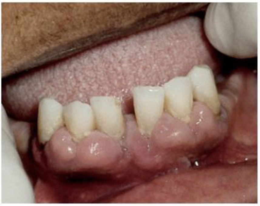 <p>CHẨN ĐOÁN?</p>