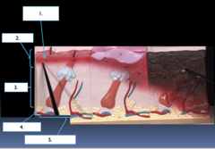 <p>What part of the burned skin model is the section labeled #5?</p>