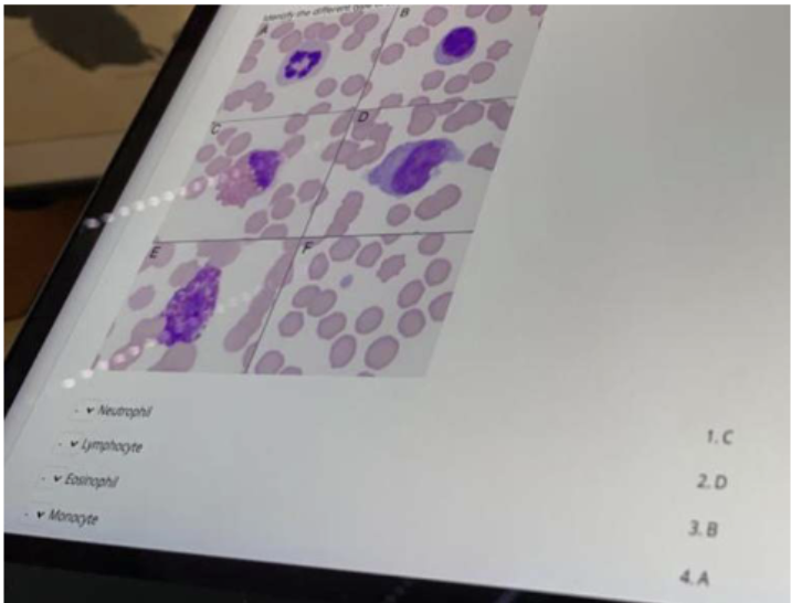 <p><span>1.C, 2.D, 3.B, 4.A, 5.E (Basophil)</span></p>