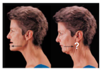 <p>moving a body part posteriorly</p>