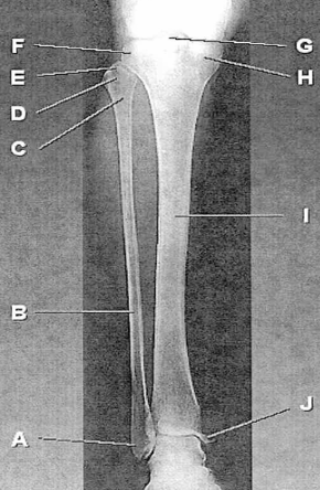<p>B</p>