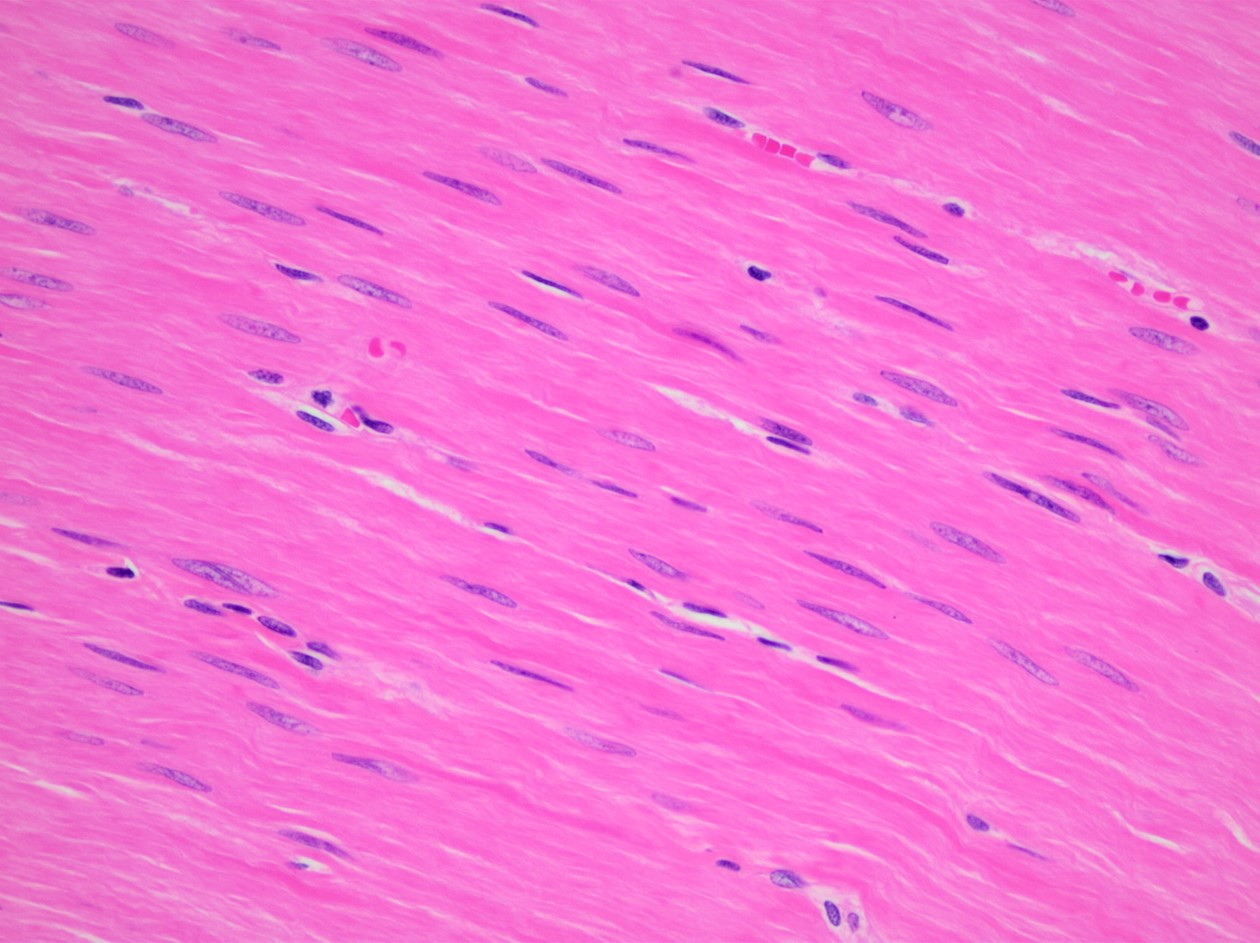<p>-Function: Involuntarily moves substances through organs and controls the diameter of passageways</p><p>-Found: Walls of the stomach, intestines, blood vessels, bladder, and airways</p><p>-Description: Non-striated, spindle-shaped cells with one central nucleus</p>