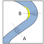 <p>erosion on the outside of the bend</p>