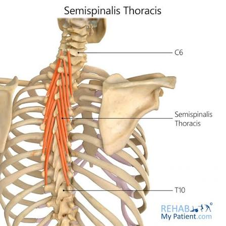 <p>semispinalis thoracis</p>
