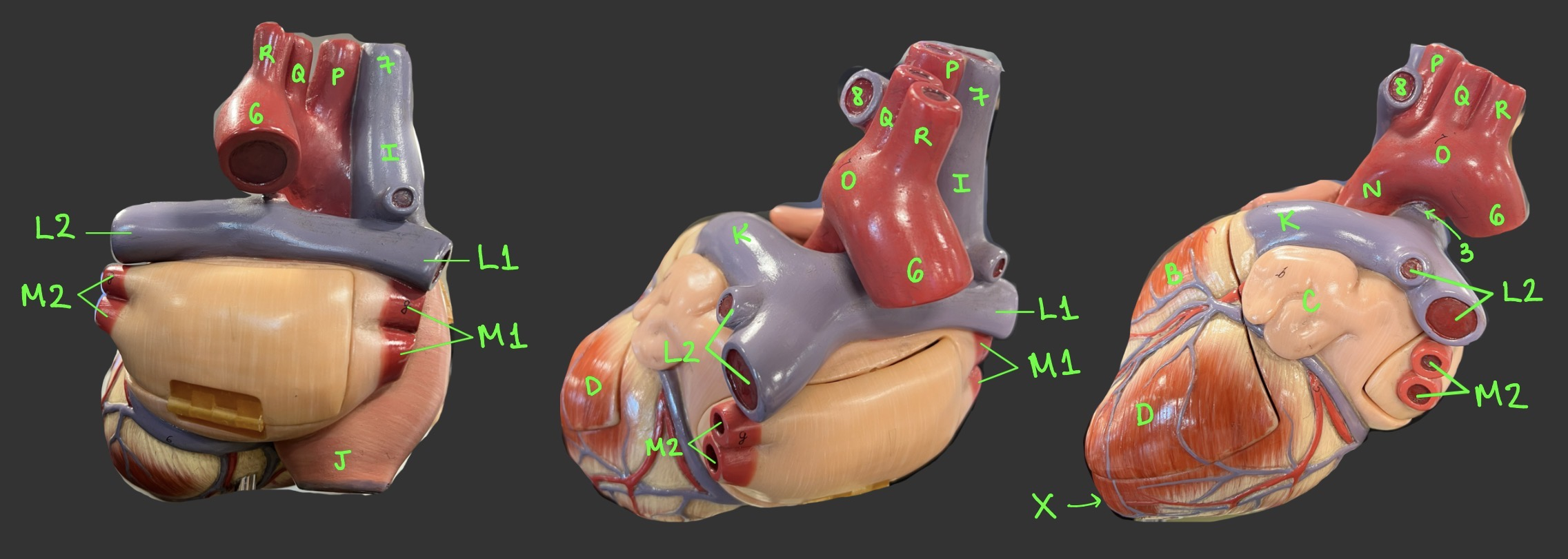 <p>What is R?</p>