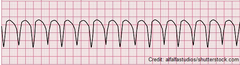 <p>identify the rhythm</p>