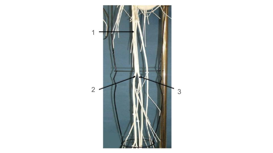 <p>3, nerve</p>
