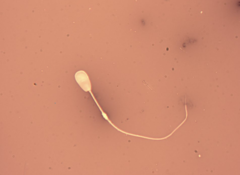 <p>What is a distal cytoplasmic droplet?</p>
