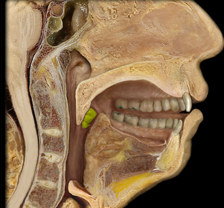 <p>paired lateral masses of lymphatic nodules at the border between the oral cavity and the oropharynx</p>