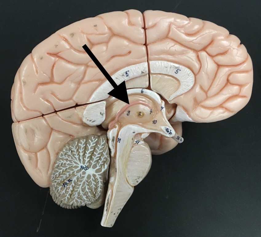 <p>What is the arrow pointing to?</p>