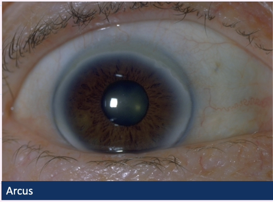 <p>Describe and give diagnosis</p>