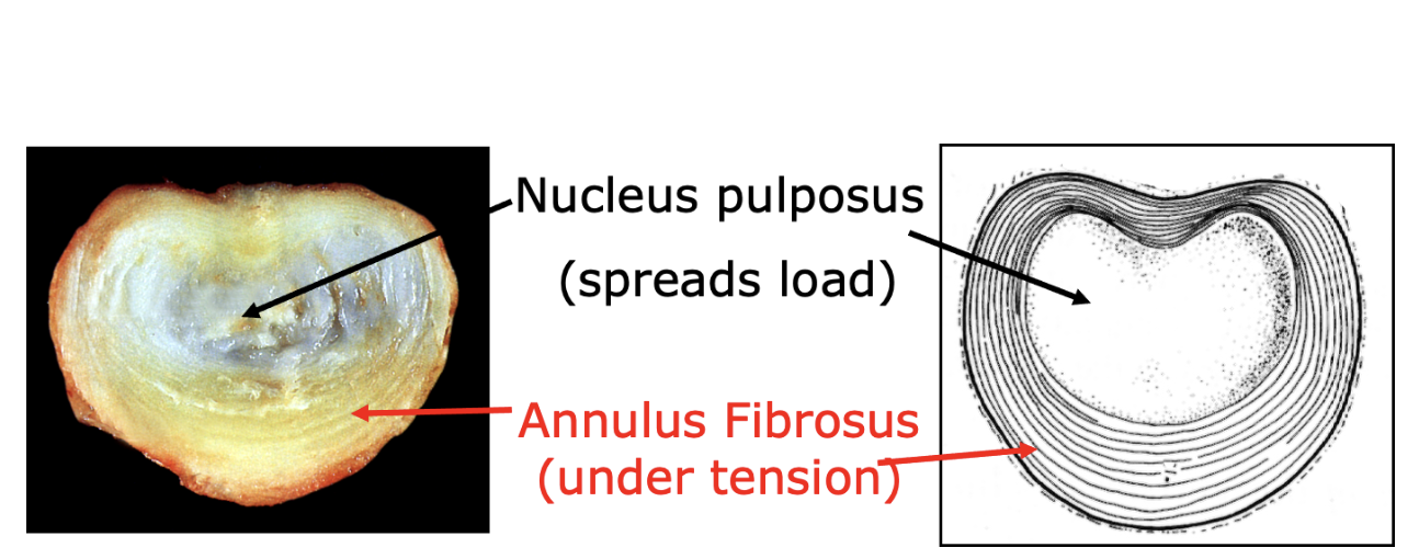 <ul><li><p><span style="background-color: transparent;">Acts as a shock absorber, and spreads load between bones to avoid overload</span></p></li><li><p><span style="background-color: transparent;">Only present between vertebral bodies: not between arches </span></p></li><li><p><span style="background-color: transparent;">Parts:</span></p><ul><li><p><span style="background-color: transparent;">Nucleus pulposus: spreads load</span></p></li><li><p><span style="background-color: transparent;">Annulus fibrosus: under tension</span></p></li></ul></li></ul><p></p>