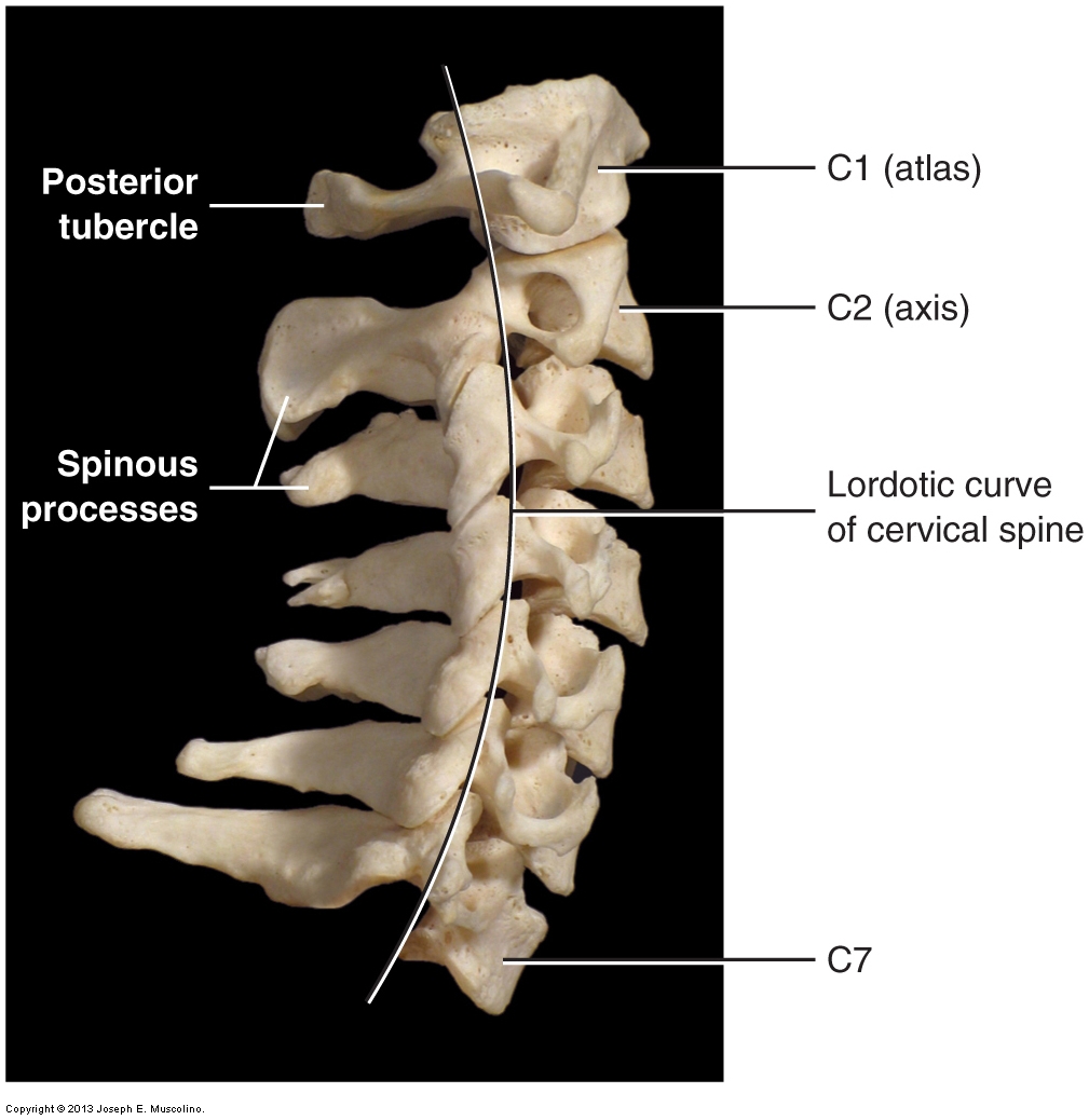 <p>Spinous Process</p>