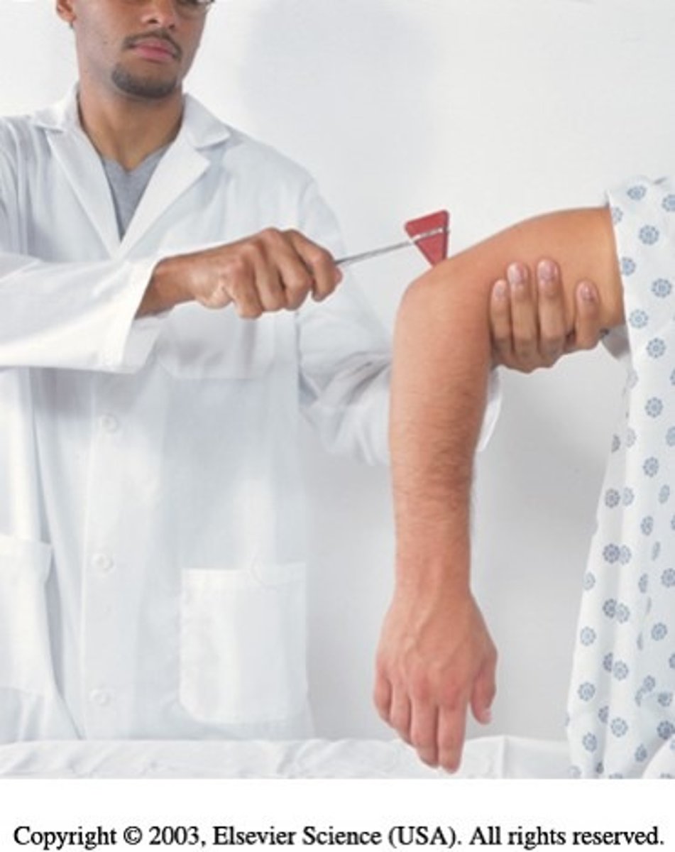 <p>tell pt. to let arm "go dead" as you strike triceps tendon just above elbow</p><p>normally forearm extends</p>
