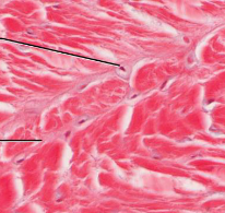 <p>fibrocartilage</p>