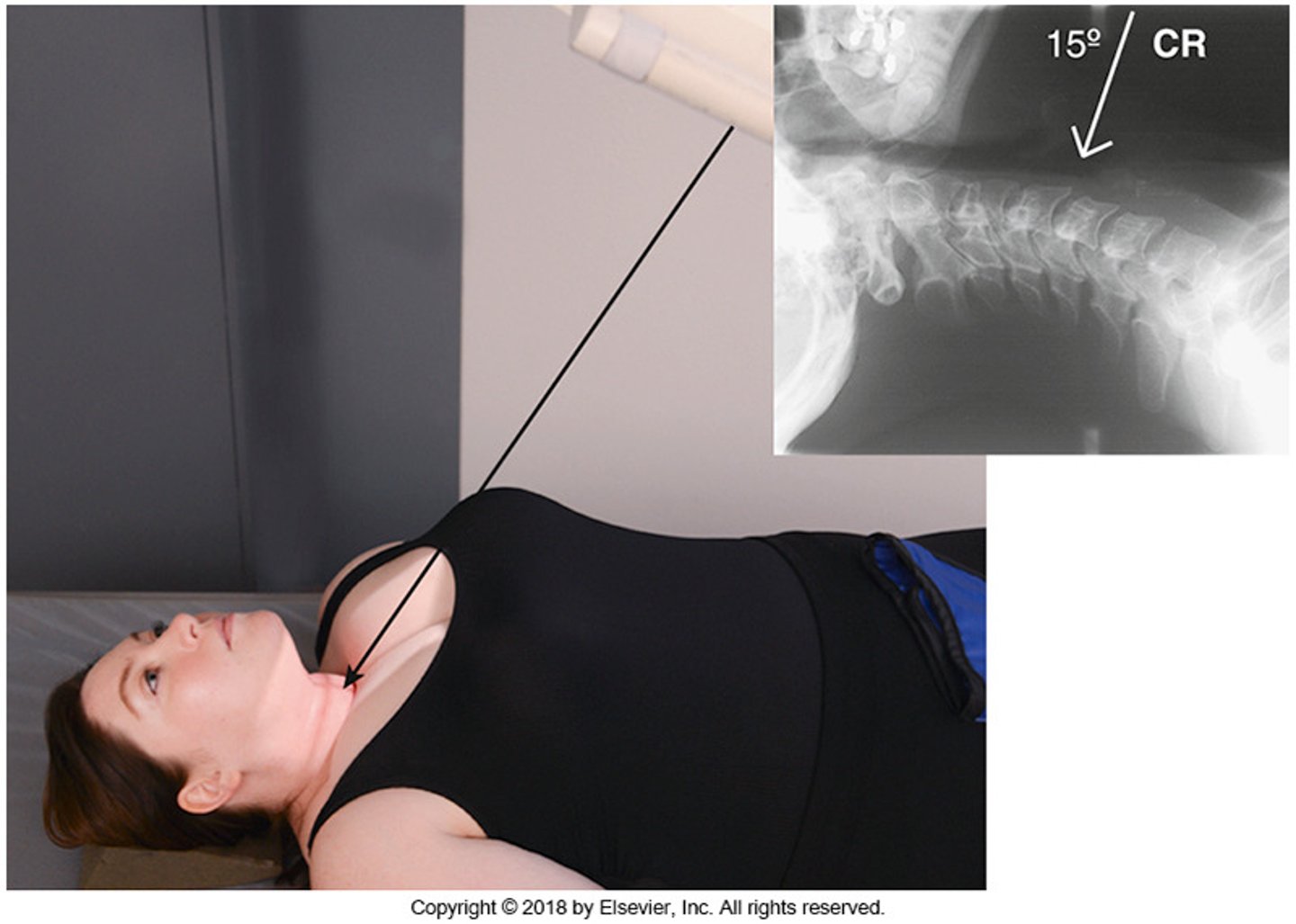 <p>- What is the exam?</p><p>- What is this view used to demonstrate?</p><p>- What is the SID?</p><p>- What is the patient's position?</p><p>- What is the angle of the CR?</p><p>- Where is the CR directed?</p><p>- What are the breathing instructions?</p><p>- What space is open?</p>