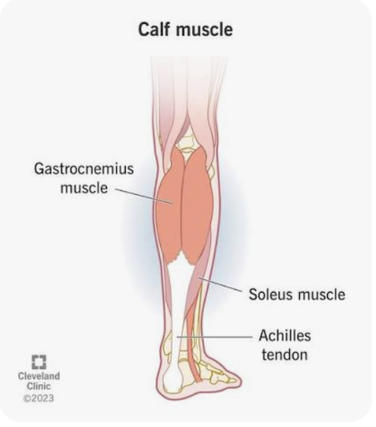 <p>O: Lateral epicondyle of the femur; medial epicondyle of the femur</p><p>I: Tuber calcanei (via the calcaneal tendon)</p><p>A: Plantarflexion of the foot when the leg is extended; flexion of the leg</p><p>N: Tibial nerve</p>