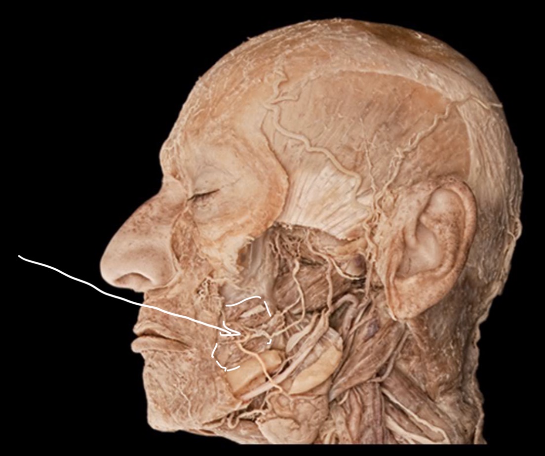 term image
