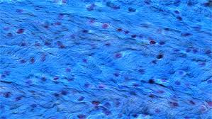 <p><strong>Fibrocartílago (</strong>más fibrocillo)</p>