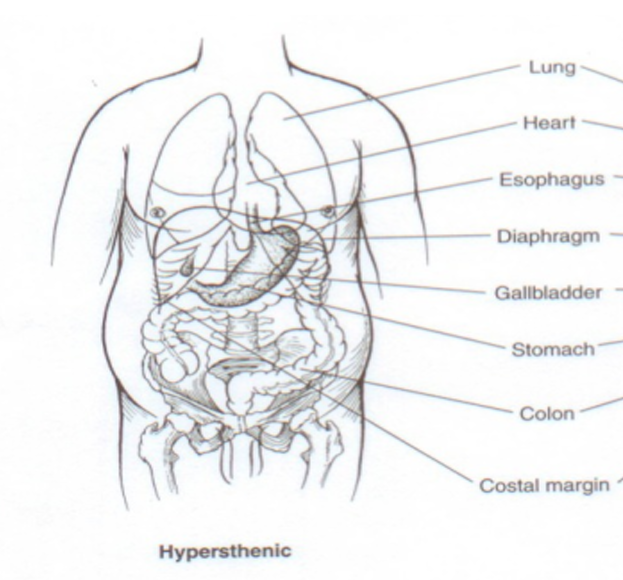 <p>Hypersthenic </p>