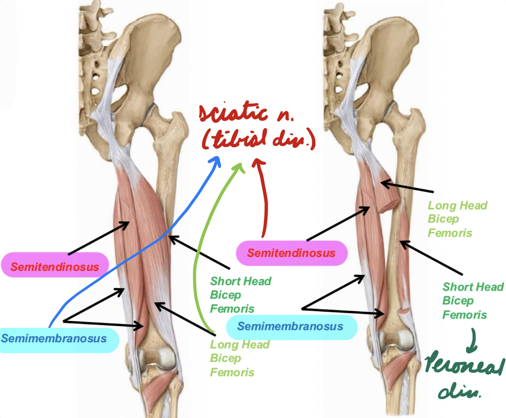 <p>Short + long head</p><p>Innervation:</p><ul><li><p>Sciatic n. → Tibial div.</p></li><li><p>Short Head: Peroneal div.</p></li></ul><p>Action:</p><ul><li><p>Hip extension</p></li><li><p>Knee flexion + rotation</p></li></ul><p></p>
