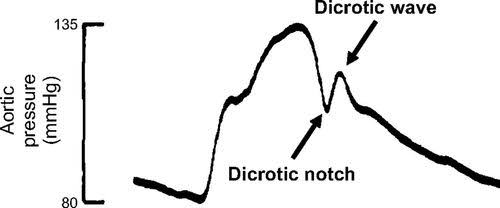 <p>Dicrotic notch</p>