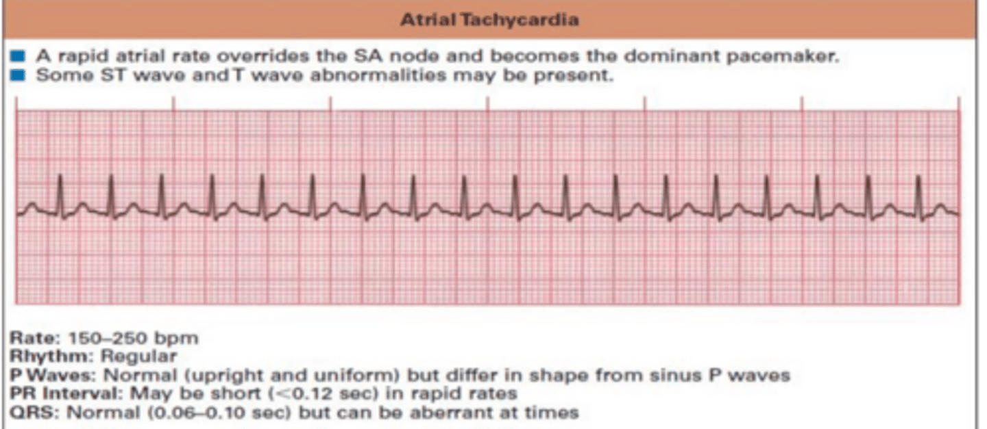<p>100-250 bpm</p>