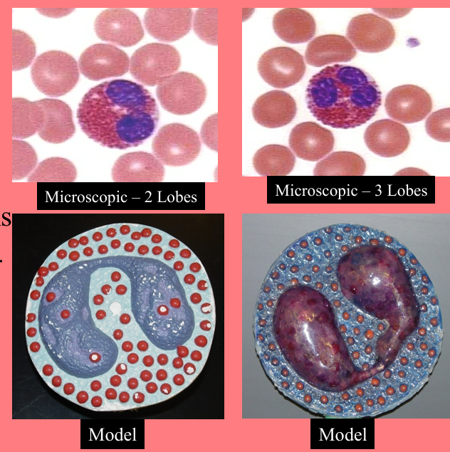 <p><span style="font-family: Arial, sans-serif;">granular (acidic-staining cytoplasmic granules)</span></p><p class="MsoNormal"><strong>2-4%</strong> of the WBCs. High in allergies</p><p class="MsoNormal">Nucleus 2 or 3 lobes connected by thin strand </p><p class="MsoNormal">·<span style="font-family: "Times New Roman"; line-height: normal; font-size: 7pt;"> </span><strong><u>Kill parasitic worms</u></strong></p><p class="MsoNormal">·<span style="font-family: "Times New Roman"; line-height: normal; font-size: 7pt;"> </span>Phagocytize/destory <strong><u>antigen-antibody complexes</u></strong></p><p class="MsoNormal">·<span style="font-family: "Times New Roman"; line-height: normal; font-size: 7pt;"> </span>Inactivate certain <strong><u>inflammatory chemicals</u></strong></p><p class="MsoNormal">Release histaminase</p><p class="MsoNormal"> –Slows down inflammation caused by basophils</p><p class="MsoNormal"> • Large, orange-red granules </p><p class="MsoNormal">• 10 to 12 microns </p><p class="MsoNormal">Low count indicates Drug toxicity, Stress</p>