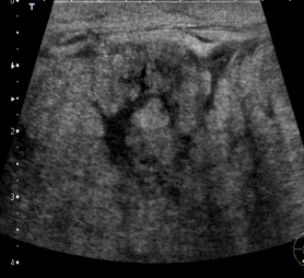 <p>Identify this image.</p>