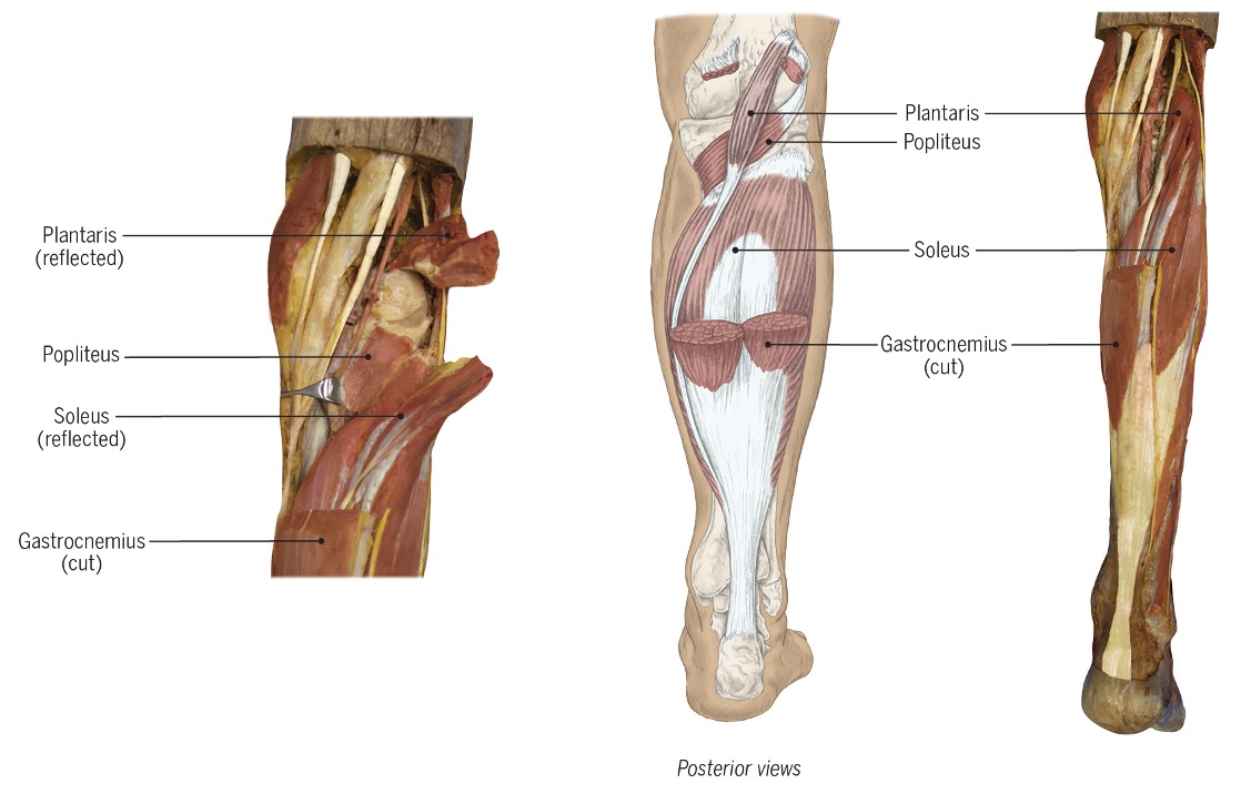 <ul><li><p><span>Gastrocnemius</span></p></li><li><p><span>Soleus</span></p></li><li><p><span>Plantaris</span></p></li></ul><p>( flex knee and ankle for acceleration activities ex: running) </p>